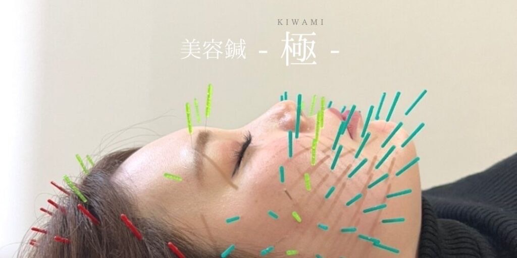 もんじゃる問屋町　美容鍼