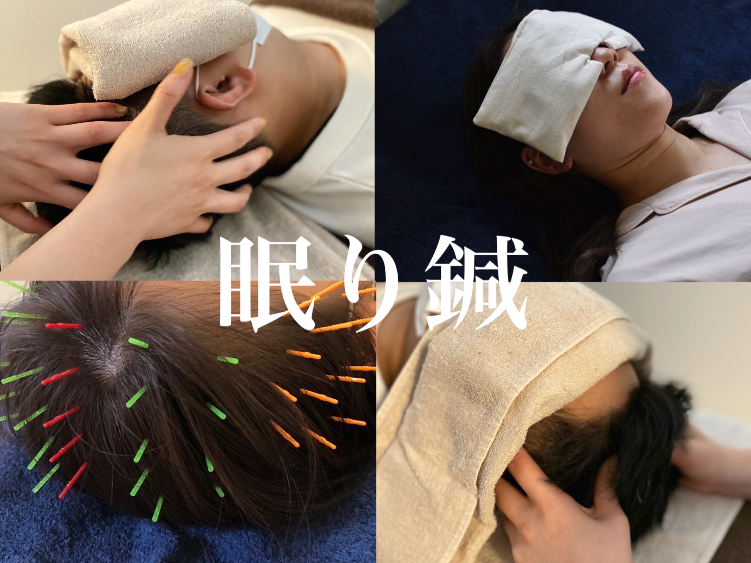もんじゃる問屋町　眠り鍼