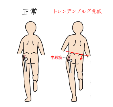 もんじゃる問屋町　筋肉