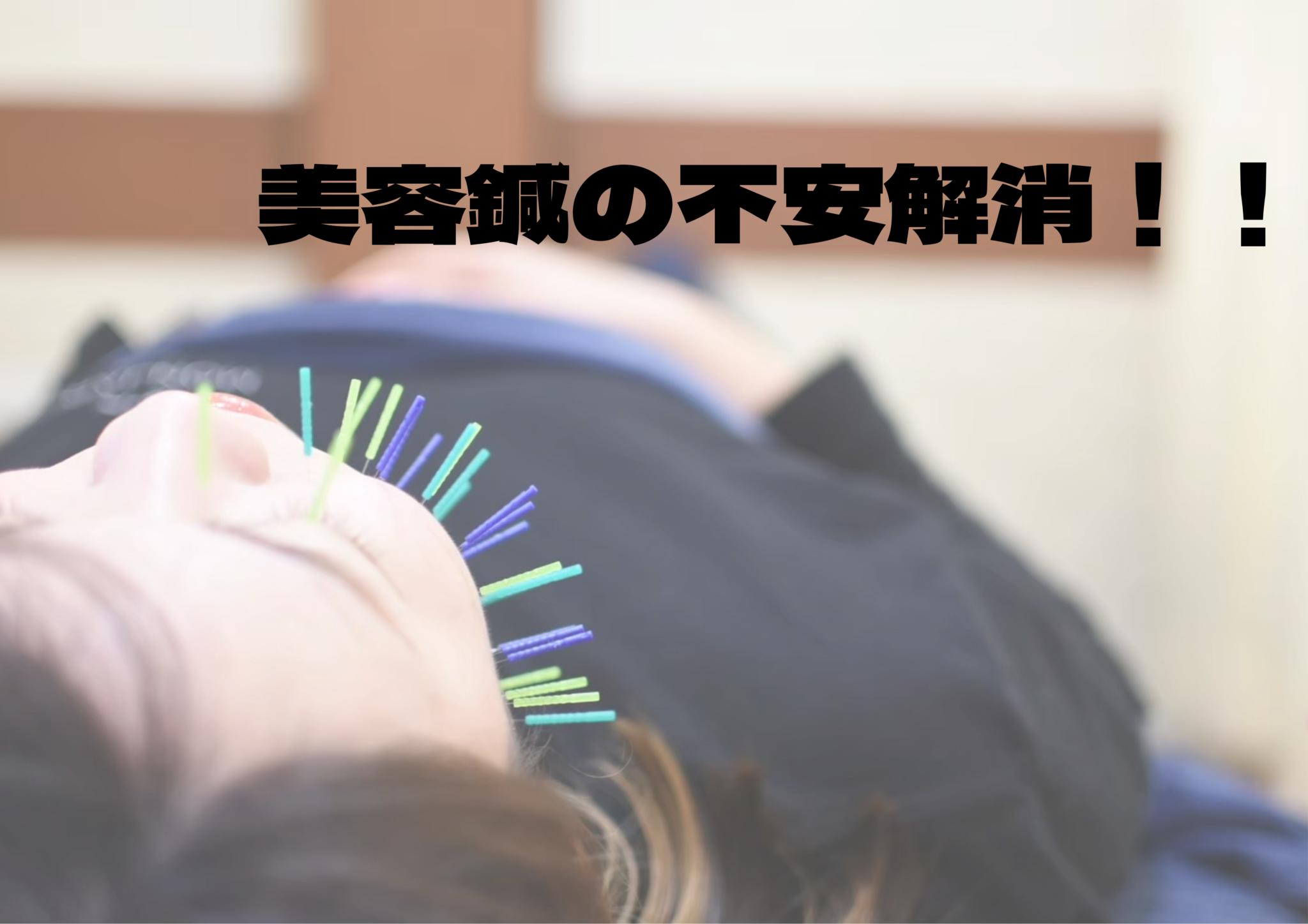 美容鍼の不安解消