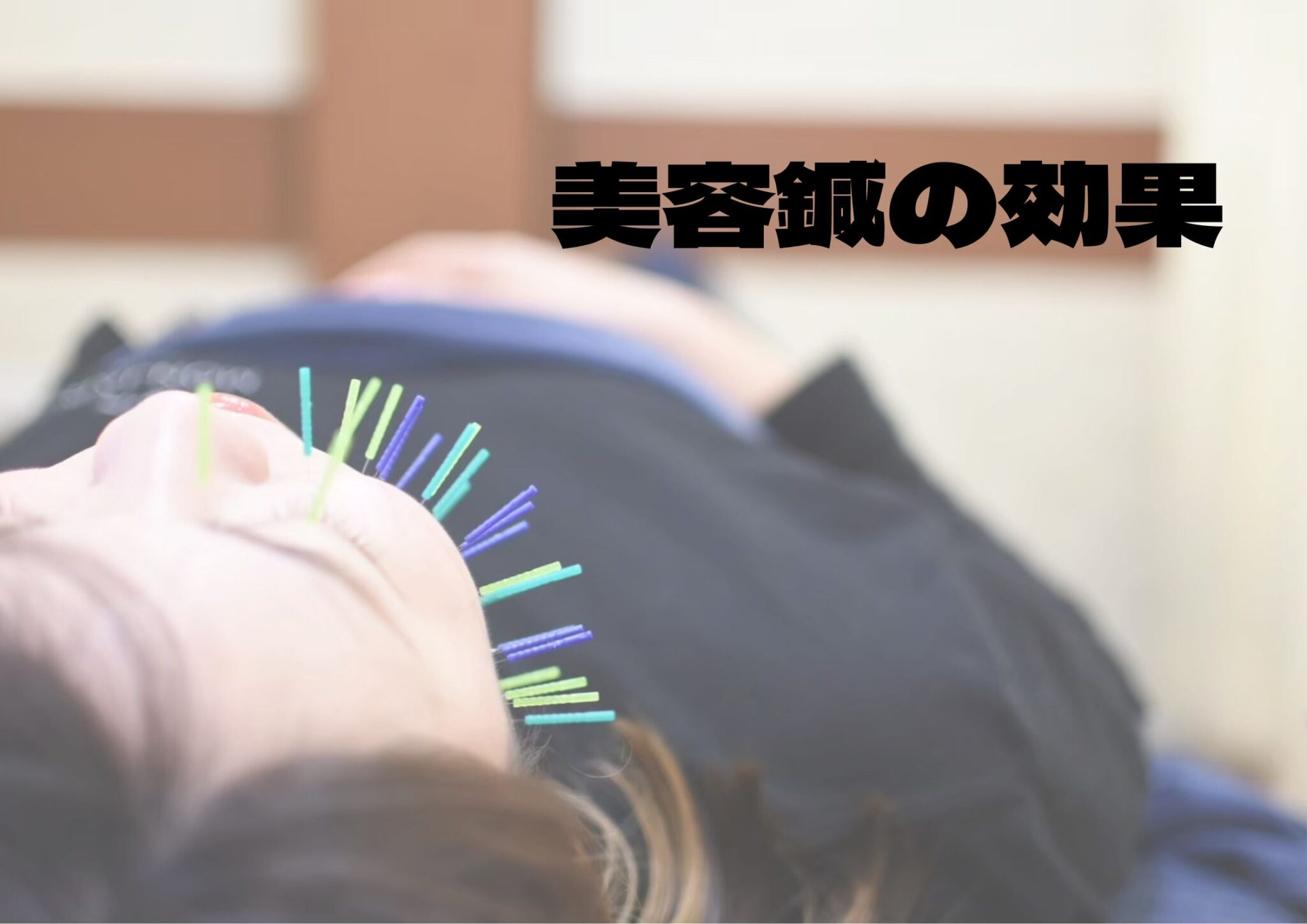 美容鍼の効果