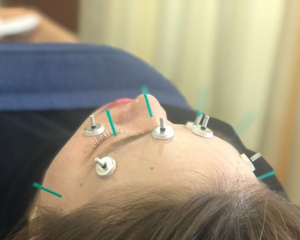 眼精疲労