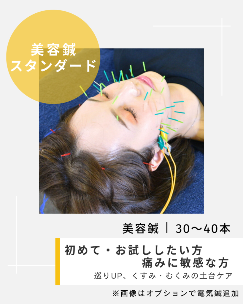 美容鍼スタンダード　40本