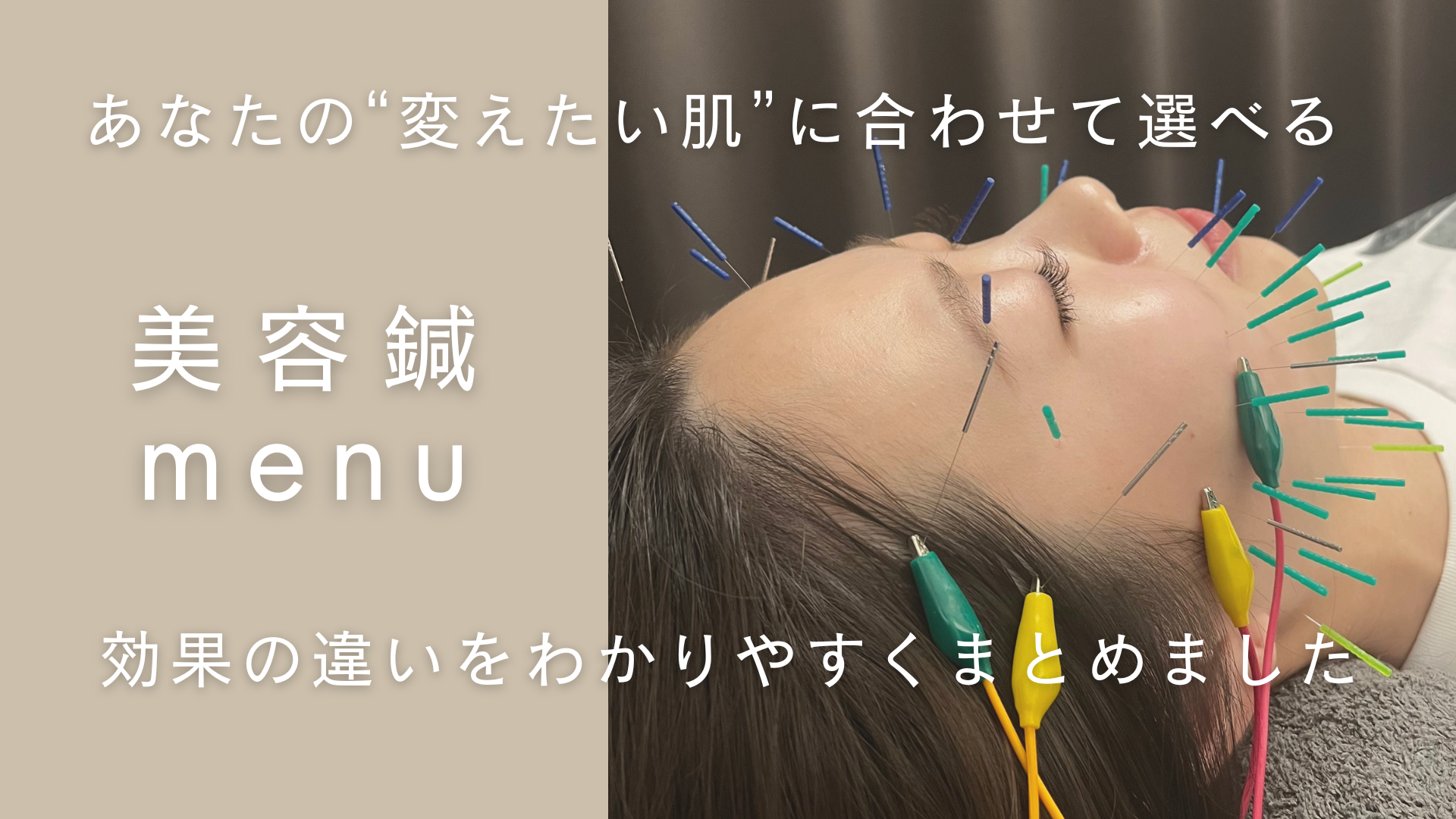美容鍼メニューの選び方