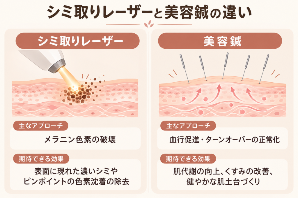 シミ取りレーザーはメラニン色素へ働きかけ、美容鍼は血行や肌のコンディションへ働きかけるという、両施術の違いを比較した図